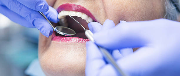 Best Emergency Dental Care for Abscessed Tooth in River Falls, WI